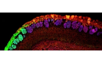 IHC: 48h-staining of PFA-perfused cryosection of mouse olfactory bulb with NCAM2 antibody at 0.5ug/ml.  HIER: pH6 citrate buffer at 95oC for 10min. Staining: NCAM2 (red), VGLUT2 (blue) and NQO1 (green).