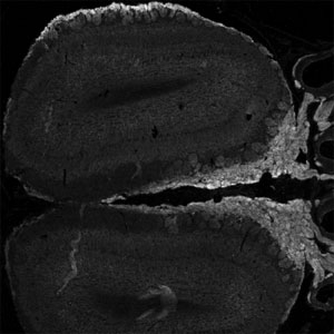IHC 24h-staining of a PFA-perfused cryosection of mouse olfactory bulb with NCAM2 antibody at 0.5ug/ml.  Strong staining of axon bundles (right middle) and moderate peripheral staining outside the glomeruli (top) is seen. Ag retrieval: methanol (-20oC, 10min), then 1% SDS (10min).