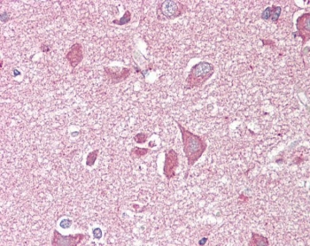IHC testing of FFPE human cortex (brain) tissue with NCAM2 antibody at 3.75ug/ml. Required HIER: steamed antigen retrieval with pH6 citrate buffer; AP-staining.