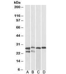 Western blot of adult mouse (A), fetal mouse (B), adult rat (C) and adult pig (D) heart lysates with TNNI3 antibody at 0.1ug/ml. Predicted molecular weight: ~24kDa, can also observed at ~28kDa.