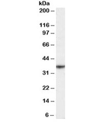 Western blot testing of human spleen lysate with NKG2D antibody at 0.3ug/ml. Predicted molecular weight ~25/35 kDa (unmodified/glycosylated).