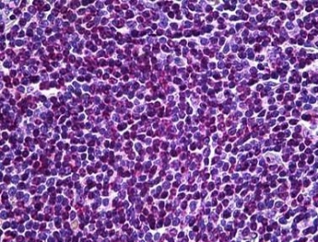 IHC testing of FFPE human spleen tissue with UBR5 antibody at 3.75ug/ml. HIER: steamed antigen retrieval with pH6 citrate buffer; AP-staining.