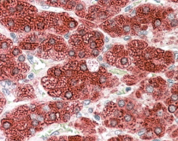 IHC staining of FFPE human adrenal gland with CYP17A1 antibody at 4ug/ml. HIER: steamed with pH6 citrate buffer, AP-staining.