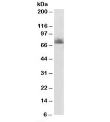 SERT Antibody Colon WB. Western blot testing of human colon lysate with SERT antibody at 2ug/ml. Expected molecular weight: ~70/85-95 kDa (unmodified/glycosylated).