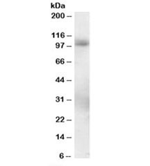Phosphodiesterase 5A Antibody Human Lung WB. Western blot analysis was performed using Phosphodiesterase 5A Antibody at 0.3 ug/ml on human lung lysate. A specific immunoreactive band is detected at approximately 100 kDa, consistent with the predicted molecular weight of the PDE5A isoforms (~100/95 kDa for isoforms 1 and 2). The clean, specific band demonstrates that this cGMP Binding Phosphodiesterase Antibody is suitable for Western blot detection of PDE5A in human tissue.