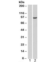 Phosphodiesterase 5A Antibody Human HEK293 Cell WB. Western blot analysis was performed using lysates from human HEK293 cells mock transfected (lane 1) or transfected to overexpress PDE5A (lane 2). Phosphodiesterase 5A Antibody was used at 0.3 ug/ml. A strong immunoreactive band is detected at approximately 100 kDa exclusively in the PDE5A-overexpressing sample, consistent with the predicted molecular weight of PDE5A isoforms (~100/95 kDa for isoforms 1 and 2), while the mock-transfected control shows no detectable signal. These results demonstrate that this cGMP Binding Phosphodiesterase Antibody specifically detects PDE5A by Western blot.