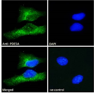 Phosphodiesterase 5A Antibody HeLa Cell IF. Immunofluorescence staining was performed on human HeLa cells using Phosphodiesterase 5A Antibody at 10 ug/ml. Bound antibody was detected with a fluorophore-conjugated secondary antibody (green), and nuclei were counterstained with DAPI (blue). The merged image demonstrates strong cytoplasmic staining with minimal nuclear signal, while the negative control shows no specific fluorescence. These results demonstrate that this cGMP Binding Phosphodiesterase Antibody is suitable for immunofluorescent detection of PDE5A in cultured human cells.