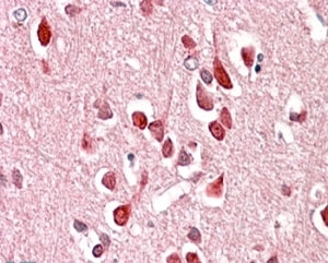 IHC staining of FFPE human cerebral cortex with UNC5C antibody at 4ug/ml. HIER: steamed with pH6 citrate buffer, AP-staining.