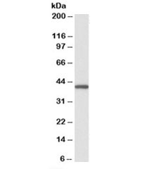 Western blot of peripheral blood lymphocyte lysate with GNAQ antibody at 0.1ug/ml. Predicted molecular weight ~42kDa.