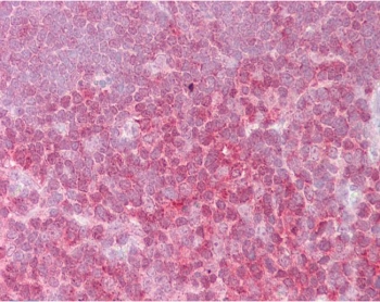 IHC testing of FFPE human thymus tissue with REL antibody at 2.5ug/ml. Required HIER: steamed antigen retrieval with pH6 citrate buffer; AP-staining.