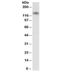 Western blot testing of human heart lysate with T-Cadherin antibody at 0.03ug/ml. Predicted molecular weight: ~83kDa, observed at 105/130kDa (glycosylated mature form/partially processed precursor). 