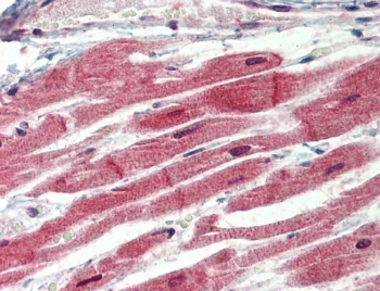 IHC testing of FFPE human heart tissue with IRAK4 antibody at 3.75ug/ml. Steamed antigen retrieval with citrate buffer pH 6, AP-staining.