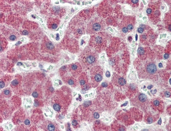 IHC testing of FFPE human liver tissue with IRAK4 antibody at 3.75ug/ml. Steamed antigen retrieval with citrate buffer pH 6, AP-staining.