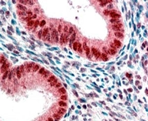 IHC staining of FFPE human uterus with HP1 antibody at 2.5ug/ml. HIER: steamed with pH6 citrate buffer, AP-staining.