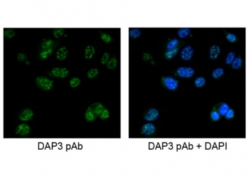 DAP3 Antibody MCF7 Cell IF. Immunofluorescent staining of human MCF7 cells with DAP3 antibody at 5ug/ml.
