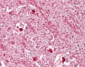 DAP3 Antibody Brain Immunohistochemistry. IHC testing of FFPE human brain cortex tissue with DAP3 antibody at 2.5ug/ml. Required HIER: steamed antigen retrieval with pH6 citrate buffer; AP-staining.
