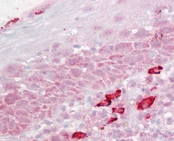 DAP3 Antibody Tonsil Immunohistochemistry. IHC testing of FFPE human tonsil tissue with DAP3 antibody at 2.5ug/ml. Required HIER: steamed antigen retrieval with pH6 citrate buffer; AP-staining.