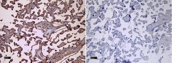 CD32 Antibody Placenta IHC. Immunohistochemistry analysis of FFPE human placental tissue stained with CD32 Antibody / Low-Affinity Fc Gamma Receptor at 8 ug/ml following HIER in pH 6 citrate buffer. Distinct HRP-DAB brown membranous and cytoplasmic staining is observed in placental trophoblast-associated cell populations, consistent with expression of FCGR2 / CD32, an Fc receptor involved in immune complex recognition and regulation of antibody-mediated immune signaling. The negative control section processed without primary antibody shows minimal background staining.