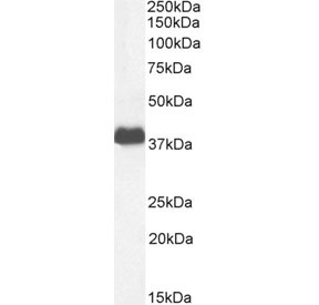 CD32 Antibody Placenta WB. Western blot analysis of human placental tissue lysate using CD32 Antibody / Low-Affinity Fc Gamma Receptor at 1 ug/ml. A prominent band is detected near 34-40 kDa, consistent with the expected glycosylation-dependent molecular weight range of FCGR2 / CD32, an Fc receptor involved in immune complex recognition and regulation of leukocyte signaling pathways.