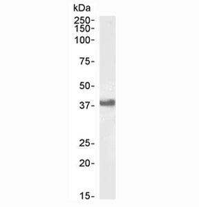 CD32 Antibody Daudi WB. Western blot analysis of human Daudi cell lysate using CD32 Antibody / Low-Affinity Fc Gamma Receptor at 1 ug/ml. A distinct band is detected near 34-40 kDa, consistent with the expected glycosylation-dependent molecular weight range of FCGR2 / CD32, an immune complex receptor involved in Fc-mediated leukocyte activation and inflammatory signaling pathways.