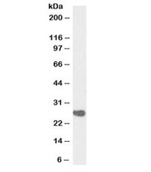 Western blot testing of pig testis lysate with CSNK2B antibody at 0.3ug/ml. Predicted molecular weight: ~25kDa.