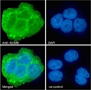 IF/ICC staining of fixed and permeabilized human A431 cells with NUMB antibody (green) at 10ug/ml and DAPI nuclear stain (blue).