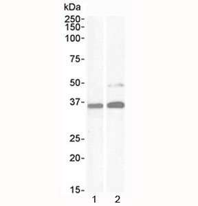 PAX8 Antibody for WB / Paired Box Protein Pax-8 Western Blot Antibody western blot analysis in human samples. Lane 1: human kidney lysate, Lane 2: human HeLa cell lysate. A band is detected at approximately 48 kDa, consistent with the predicted molecular weight of Paired box protein Pax-8 (PAX8). Additional bands between ~31-43 kDa correspond to known PAX8 isoforms, while a higher band near ~62 kDa may reflect post-translationally modified forms of the protein, such as phosphorylation-dependent mobility shifts. The banding pattern aligns with reported isoform diversity and transcription factor regulation, supporting specific detection of PAX8 across different human cell types.