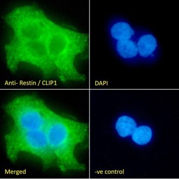 Immunofluorescent staining of fixed and permeabilized human A431 cells with CLIP antibody (green) at 10ug/ml and DAPI nuclear stain (blue).