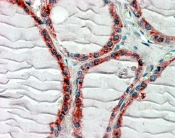 IHC staining of FFPE human thyroid gland with CLIP antibody with 2.5ug/ml. HIER: steamed with pH6 citrate buffer, AP-staining.