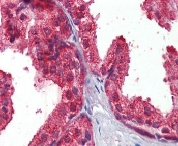 IHC staining of FFPE human prostate tissue with CLIP antibody with 2.5ug/ml. HIER: steamed with pH6 citrate buffer, AP-staining.