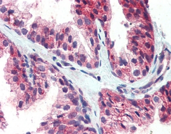 CDCP1 Antibody Goat Polyclonal immunohistochemistry analysis of human prostate tissue. Formalin-fixed paraffin-embedded human prostate stained with CDCP1 Antibody Goat Polyclonal at 5 ug/ml. Red chromogenic staining highlights membranous and cytoplasmic signal in glandular epithelial cells, consistent with the expected cell surface localization of CDCP1 / CD318. Required HIER: steamed antigen retrieval with pH6 citrate buffer; AP-staining.