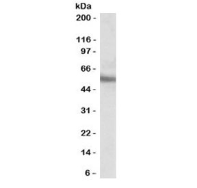 ERG Antibody MOLT4 WB. Western blot testing of human MOLT4 cell lysate with ERG antibody at 0.1ug/ml. Predicted molecular weight ~54 kDa.