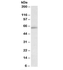 HIC2 Antibody HepG2 Cell WB. Western blot testing of HepG2 lysate with HIC2 antibody at 0.1ug/ml. Predicted molecular weight: ~66 kDa.