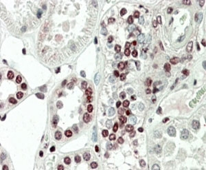MAPKAPK5 Antibody Kidney IHC. Immunohistochemistry analysis of FFPE human kidney tissue stained with goat polyclonal MAPKAPK5 antibody at 5 ug/ml. Following HIER in pH 6 citrate buffer, prominent AP-red nuclear staining is observed in renal tubular epithelial cells, consistent with the known stress-responsive and ERK3-associated signaling functions of MAPKAPK5 / PRAK.