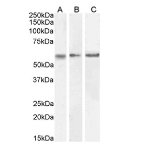 CAMK2A Antibody Human, Mouse and Rat Brain WB. Western blot testing of A) human cerebellum, B) mouse brain, and C) rat brain tissue lysates (35 ug protein per lane) with CAMK2A antibody. A distinct immunoreactive band is detected at approximately 54 kDa in all three brain lysates, consistent with the predicted molecular weight of Calcium/Calmodulin Dependent Protein Kinase II Alpha (CAMK2A). The results demonstrate cross-species detection of this neuronal serine/threonine kinase, which plays essential roles in calcium-dependent signaling, synaptic plasticity, learning, memory, and neuronal signal transduction.