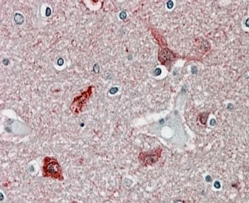CAMK2A Antibody Human Brain Cortex IHC. Immunohistochemical staining of FFPE human brain cortex tissue with CAMK2A antibody at 4 ug/ml using alkaline phosphatase (AP) detection. Heat-induced epitope retrieval (HIER) was performed by steaming tissue sections in pH 6 citrate buffer prior to staining. CAMK2A immunoreactivity is observed predominantly within cortical neurons and the surrounding neuropil, consistent with the expected distribution of Calcium/Calmodulin Dependent Protein Kinase II Alpha (CAMK2A), a neuronal serine/threonine kinase that regulates calcium-dependent signaling, synaptic plasticity, learning, and memory.