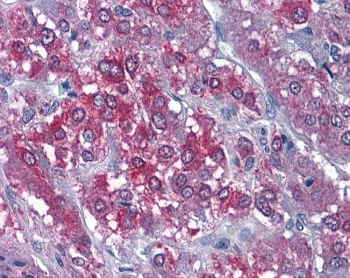 CAMK2A Antibody Human Adrenal Gland IHC. Immunohistochemical staining of FFPE human adrenal gland tissue with CAMK2A antibody at 3.75 ug/ml using alkaline phosphatase (AP) detection. Heat-induced epitope retrieval (HIER) was performed by steaming tissue sections in pH 6 citrate buffer prior to staining. CAMK2A immunoreactivity is observed predominantly within the cytoplasm of adrenal cortical cells, consistent with the expected expression of Calcium/Calmodulin Dependent Protein Kinase II Alpha (CAMK2A), a calcium signaling kinase that regulates calcium-dependent signal transduction, protein phosphorylation, and stimulus-responsive cellular signaling pathways.