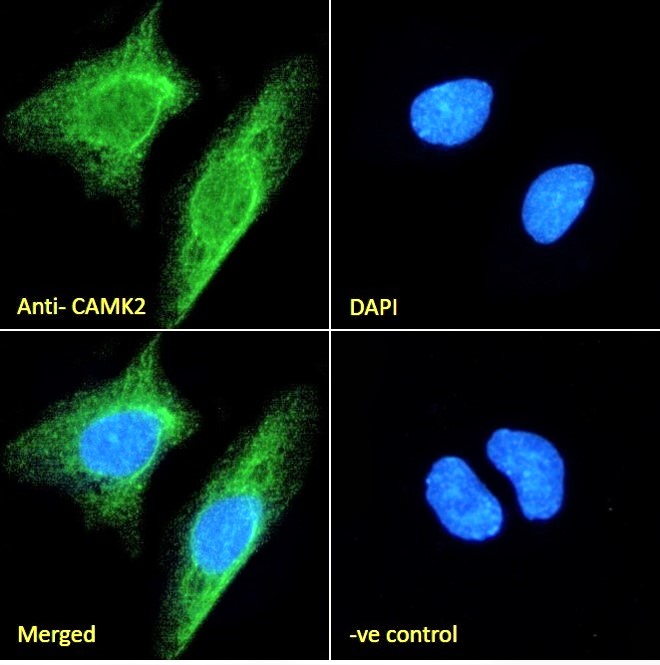CAMK2A Antibody U2OS Cell IF. Immunofluorescent staining of paraformaldehyde-fixed U2OS cells with CAMK2A antibody (green). Cells were permeabilized with 0.15% Triton X-100 prior to staining, followed by Alexa Fluor 488-conjugated secondary antibody. Nuclei are counterstained with DAPI (blue). CAMK2A immunoreactivity is observed predominantly within the cytoplasm, consistent with the expected localization of Calcium/Calmodulin Dependent Protein Kinase II Alpha (CAMK2A), a calcium signaling kinase that regulates calcium-dependent signal transduction, protein phosphorylation, and downstream cellular signaling pathways. The negative control using unimmunized goat IgG showed no specific staining.