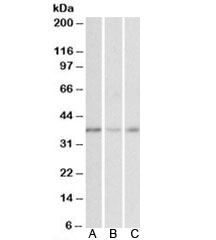 Western blot testing of human cerebellum (A), duodenum (B) and heart (C) lysates with MICS1 antibody at 0.01ug/ml. Predicted molecular weight: ~38 kDa.