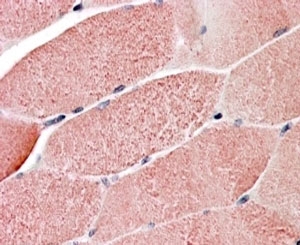 IHC staining of FFPE human skeletal muscle with TRIM7 antibody at 4ug/ml. HIER: steamed with pH6 citrate buffer, AP-staining.