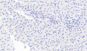 Negative control: IHC staining of FFPE human liver tissue without primary antibody. Required HIER: steamed antigen retrieval with pH6 citrate buffer; HRP-staining.