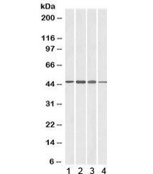 Western blot testing of brain lysate from 1) human, 2) mouse, 3) rat and 4) pig with ADAP1 antibody at 1ug/ml. Predicted molecular weight: ~43kDa.