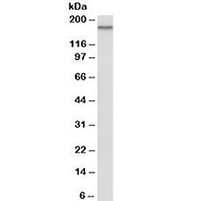 Western blot testing of HeLa lysate with EGFR antibody at 0.1ug/ml. Predicted molecular weight ~134kDa. The higher band likely represents a glycosylated form of the protein.