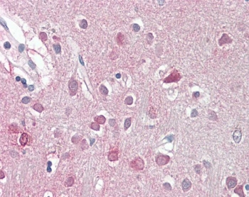 IHC testing of FFPE human brain cortex with ORC3L antibody at 3.75ug/ml. Required HIER: steamed antigen retrieval with pH6 citrate buffer; AP-staining.