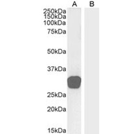 Western blot testing of human testis lysate (A) and human skin lysate (B, negative control) with GDF15 antibody at 0.3ug/ml. Predicted molecular weight ~34 kDa (pro-form) and ~25 kDa (mature form).