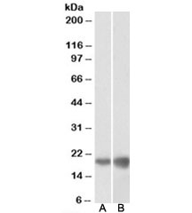 Deoxyuridine Triphosphatase Antibody HEK293 and HeLa WB. Western blot analysis of HEK293 and HeLa cell lysates using Deoxyuridine Triphosphatase Antibody demonstrates detection of a band at approximately 18 kDa, consistent with the mature nuclear isoform of DUT. Deoxyuridine Triphosphatase is a nucleotide metabolism enzyme that regulates intracellular dUTP pools and prevents inappropriate uracil incorporation into DNA, thereby supporting DNA replication fidelity and genome maintenance. DUT is known to exist as multiple isoforms, including a longer precursor form and a shorter processed nuclear form. The observed band is consistent with the mature nuclear isoform commonly detected in proliferating human cells. Western blot was performed using 0.1 ug/ml primary antibody. Predicted molecular weights: ~27 kDa (isoform 1) and ~18 kDa (isoform 2).