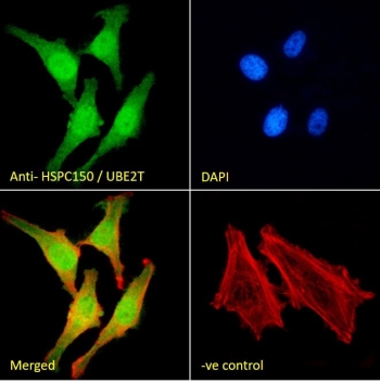 Immunofluorescent staining of fixed and permeabilized human HeLa cells with UBE2T antibody (green) at 10ug/ml, DAPI nuclear stain (blue) and Phalloidin (red).