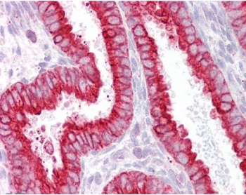 IHC testing of FFPE human uterus tissue with CHRNB2 antibody at 2.5ug/ml. Required HIER: steamed antigen retrieval with pH6 citrate buffer; AP-staining.
