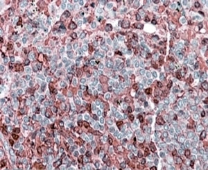 IHC staining of FFPE human spleen with NFATC2 antibody at 4ug/ml. HIER: steamed with pH6 citrate buffer, AP-staining.