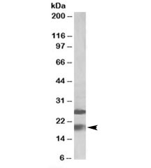 Western blot testing of human frontal cortex lysate with MPV17 antibody at 2ug/ml. The expected ~19kDa band and additional ~26kDa band are both blocked by immunizing peptide.